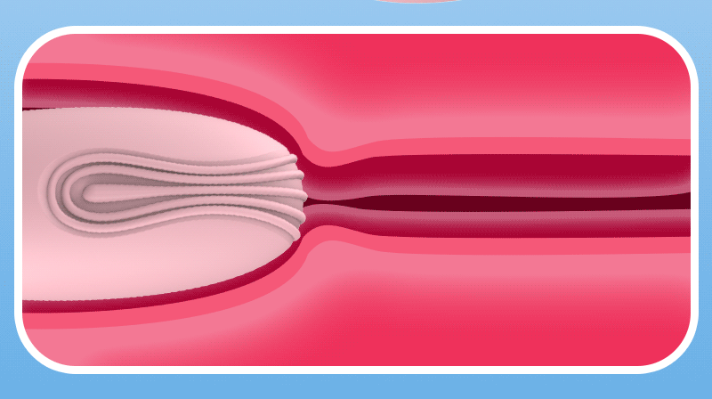 Little Whale Lilo vibrating egg, a discreet and powerful pleasure toy for women